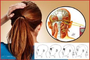 Triệu chứng đặc trưng của bệnh đau dây thần kinh chẩm