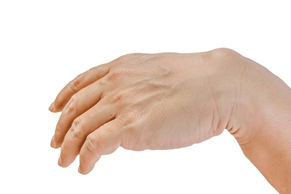 Cách chăm sóc và duy trì sức khỏe cho bàn tay trong trường hợp bị nhức đau là gì?

Lưu ý: Đây chỉ là một ví dụ về cách tạo câu hỏi và không bao gồm các câu trả lời. Cần tham khảo các nguồn tin đáng tin cậy để có câu trả lời đầy đủ và chính xác.
