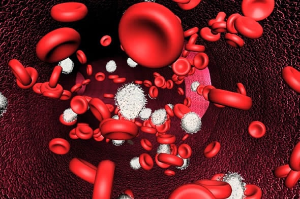 Bạch cầu trong máu cao có thể gây ra những biến chứng nào?
