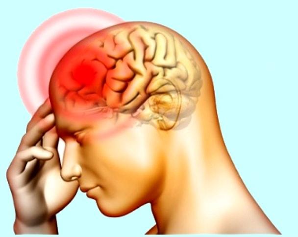 Tổng hợp: Bệnh đau đầu hay nhức đầu nguy hiểm hơn bạn nghĩ