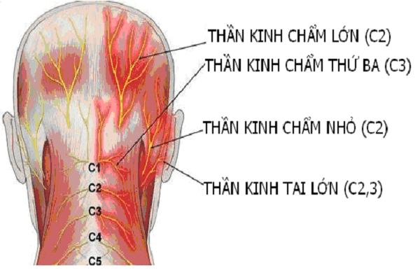 Có những biện pháp điều trị nào hiệu quả để giảm đau thần kinh chẩm?
