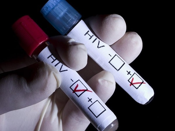 Tại sao quan trọng phát hiện HIV giai đoạn đầu và điều trị sớm?