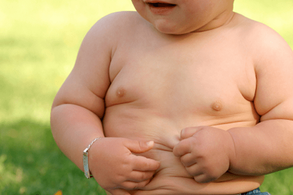 Phân biệt và nhận biết triệu chứng bệnh béo phì ở trẻ em dễ dàng
