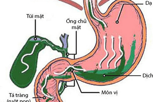 Cách điều trị và chữa bệnh trào ngược thực quản hiện nay