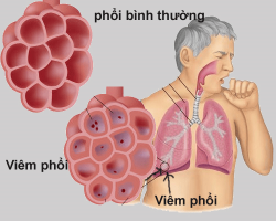 Hô Hấp Tiếng Anh Là Gì? Ý Nghĩa, Cách Sử Dụng và Phân Biệt Các Thuật Ngữ