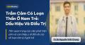 Trầm Cảm Có Loạn Thần Ở Nam Trẻ: Dấu Hiệu Và Điều Trị Trầm Cảm Có Loạn Thần Ở Nam Trẻ: Dấu Hiệu Và Điều Trị