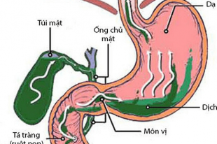Cách điều trị và chữa bệnh trào ngược thực quản hiện nay