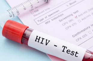 Phơi nhiễm HIV là gì, cách xử lý khi bị phơi nhiễm? Phơi nhiễm HIV là gì, cách xử lý khi bị phơi nhiễm?