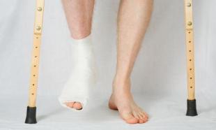 Teo cơ chân sau bó bột Teo cơ chân sau bó bột