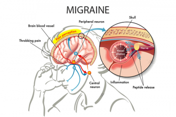 4. Cách phòng ngừa đau nhói ở đầu bên phải