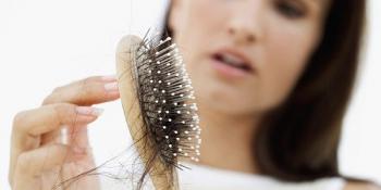 Triệu chứng rụng nhiều tóc, nguyên nhân và cách chữa trị