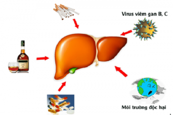 Nguyên nhân viêm gan C: Những điều cần biết để bảo vệ sức khỏe