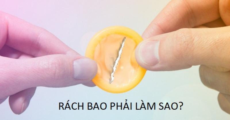 Hỏi đáp: Làm gì khi quan hệ bị rách bao? Nguy cơ gì? Hỏi đáp: Làm gì khi quan hệ bị rách bao? Nguy cơ gì?