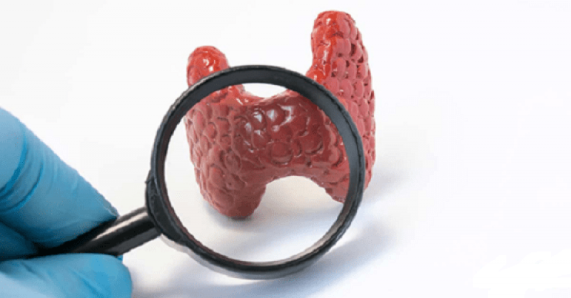 Bệnh cường giáp có phải là ung thư không - hỏi đáp nhanh bác sĩ