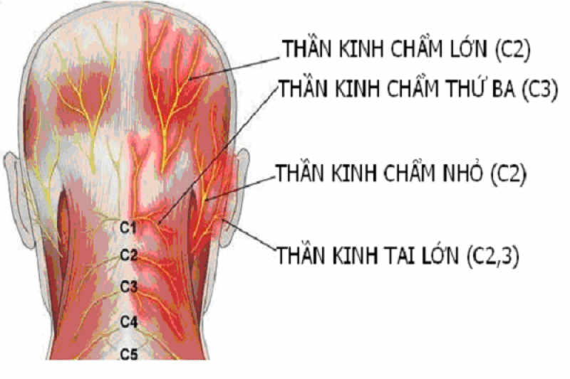 Đau dây thần kinh chẩm