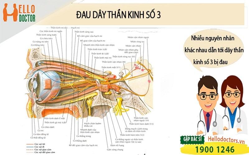 Đau dây thần kinh số 3