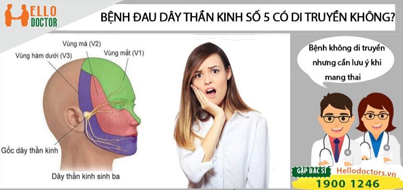 Bệnh đau dây thần kinh số 5 có di truyền không?