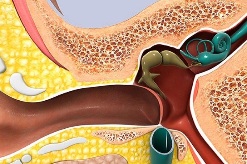 Rối loạn tiền đình - tổn thương dây thần kinh số 8