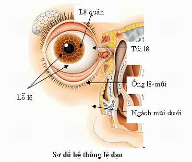 Bị chảy nước mắt sống có biểu hiện của bệnh gì?
