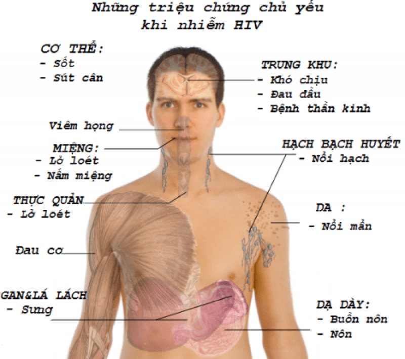 Bị mắc bệnh nhiễm HIV thì thường có triệu chứng gì?