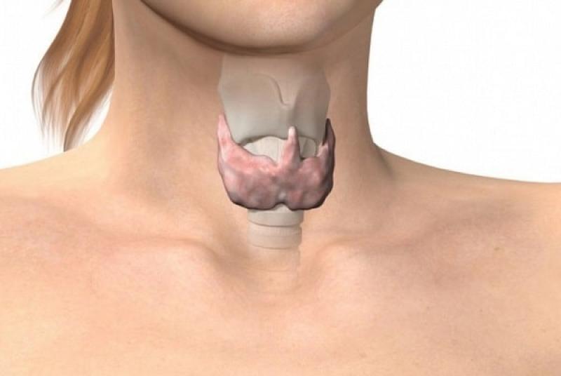 Bướu giáp lan tỏa có những loại nào - cách để nhận biết