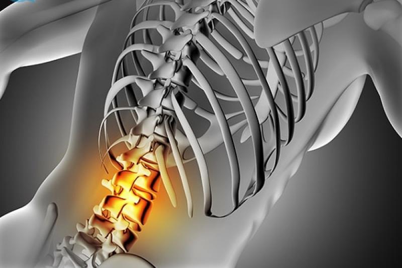 Các cách điều trị và chữa bệnh gai cột sống hiện nay