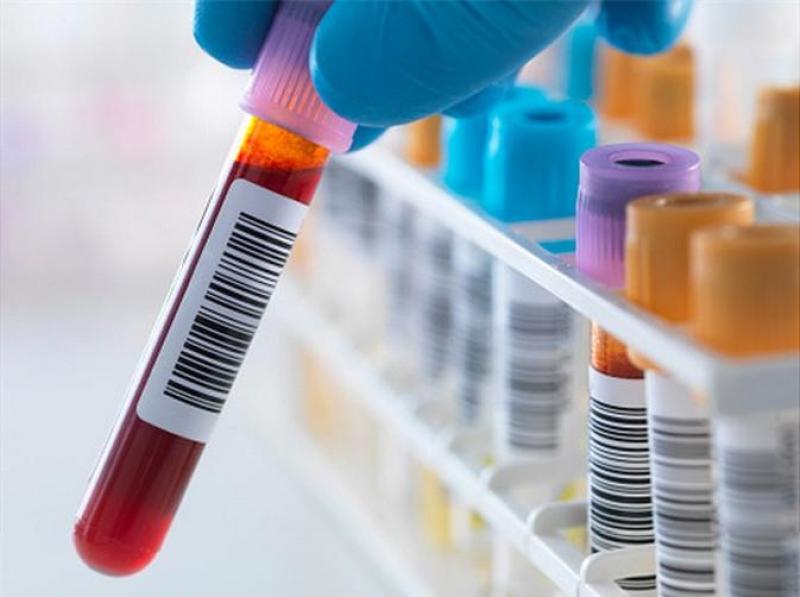 Các cách xét nghiệm máu HIV nhanh và chính xác nhất