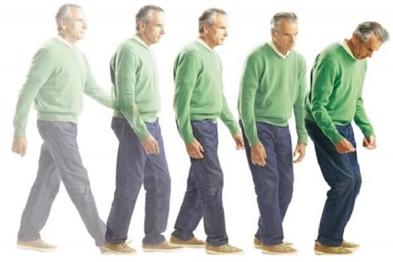 Cách điều trị bệnh Parkinson như thế nào