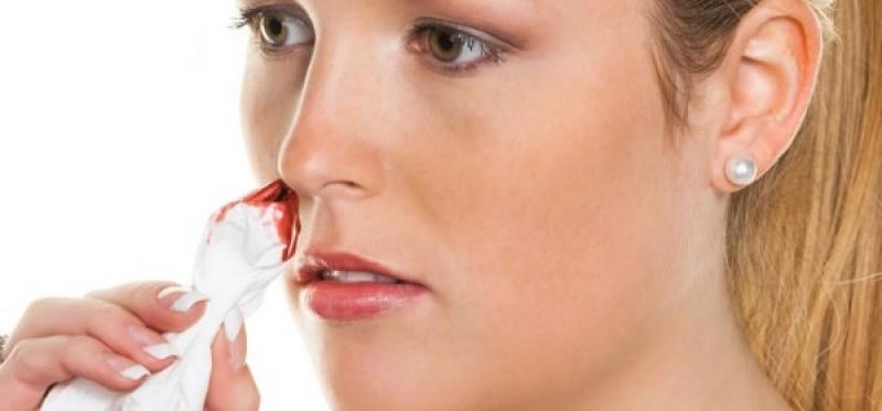 Chảy máu mũi là biểu hiện của bệnh gì?