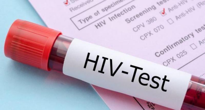 Xét nghiệm HIV phát hiện kháng thể và kháng nguyên
