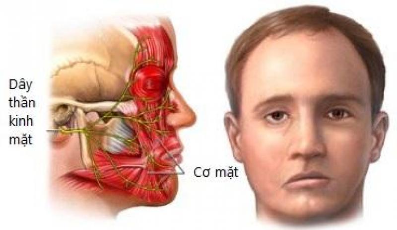 Co giật cơ mặt liên tục