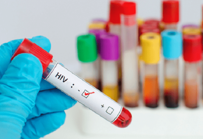 Phân loại xét nghiệm chẩn đoán HIV, thời gian biết kết quả