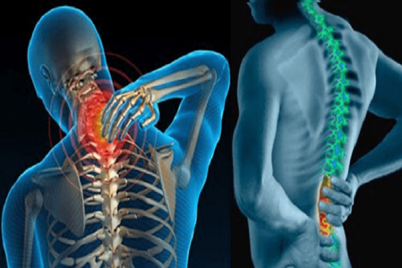 Dấu hiệu, biểu hiện và triệu chứng của bệnh gai cột sống