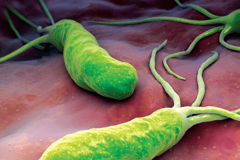 Dấu hiệu, triệu chứng bệnh nhiễm khuẩn Helicobacter pylori HP Dấu hiệu, triệu chứng bệnh nhiễm khuẩn Helicobacter pylori HP