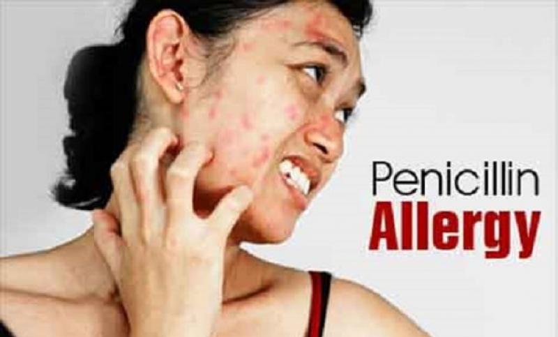 Dị ứng Pe-ni-cil-lin Dị ứng Pe-ni-cil-lin