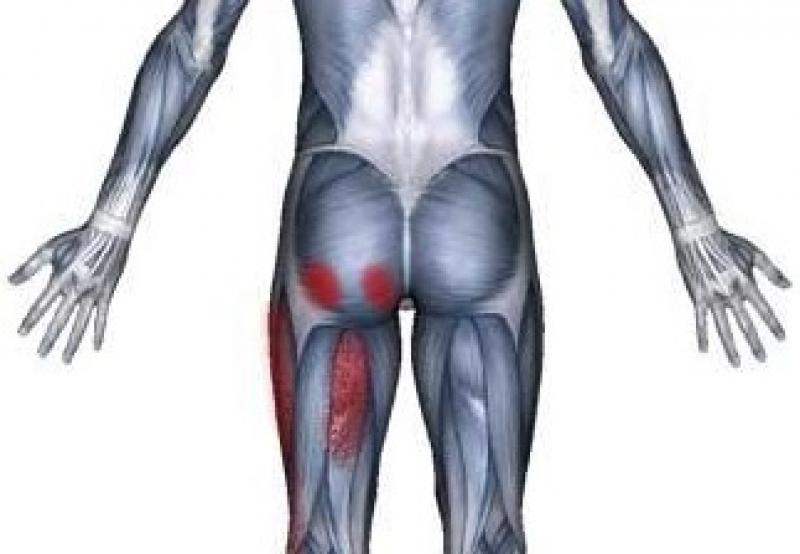 Hiện tượng co giật cơ mông - Nguyên nhân và cách điều trị