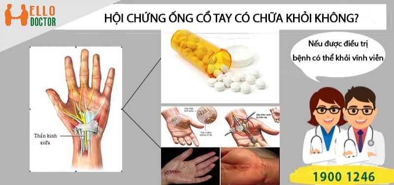 Hội chứng ống cổ tay có chữa khỏi được không?