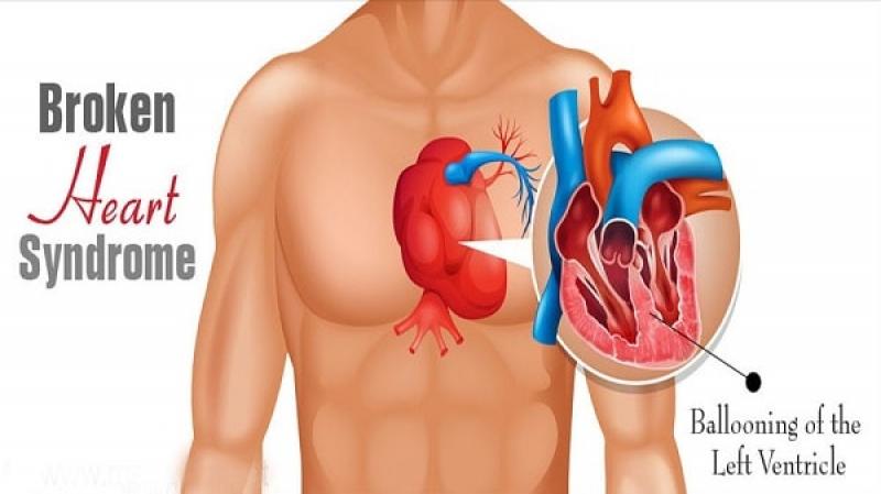 Hội chứng trái tim tan vỡ