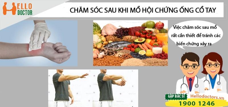 Hướng dẫn cách chăm sóc sau khi mổ hội chứng ống cổ tay