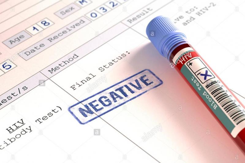 Cần chờ bao lâu để biết chính xác kết quả xét nghiệm HIV Cần chờ bao lâu để biết chính xác kết quả xét nghiệm HIV