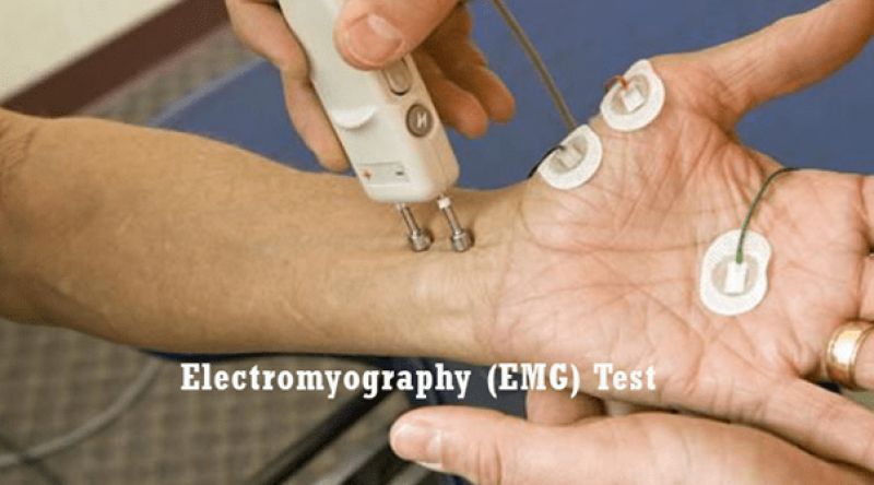 Làm cách nào để phát hiện sớm bệnh teo cơ?