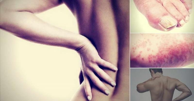 Làm thế nào để biết mình có bị nhiễm bệnh hiv?