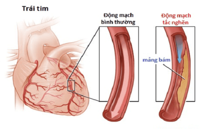 Mạch máu nhỏ