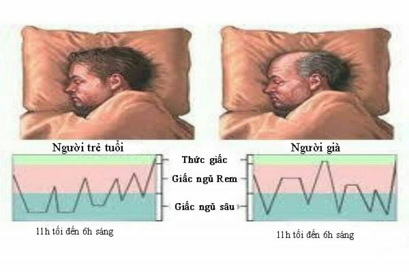 Mất ngủ ở người cao tuổi Mất ngủ ở người cao tuổi