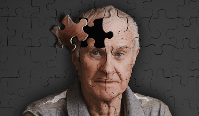 Nên đi khám và điều trị bệnh Alzheimer ở đâu?