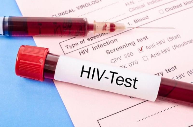 Nên xét nghiệm HIV khi nào? Sau thời gian phơi nhiễm bao lâu? Nên xét nghiệm HIV khi nào? Sau thời gian phơi nhiễm bao lâu?