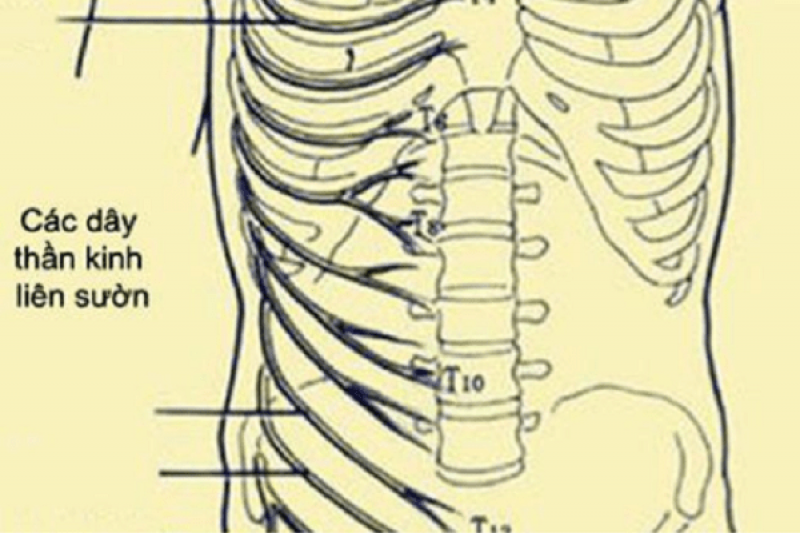 Nguyên nhân của bệnh đau dây thần kinh liên sườn