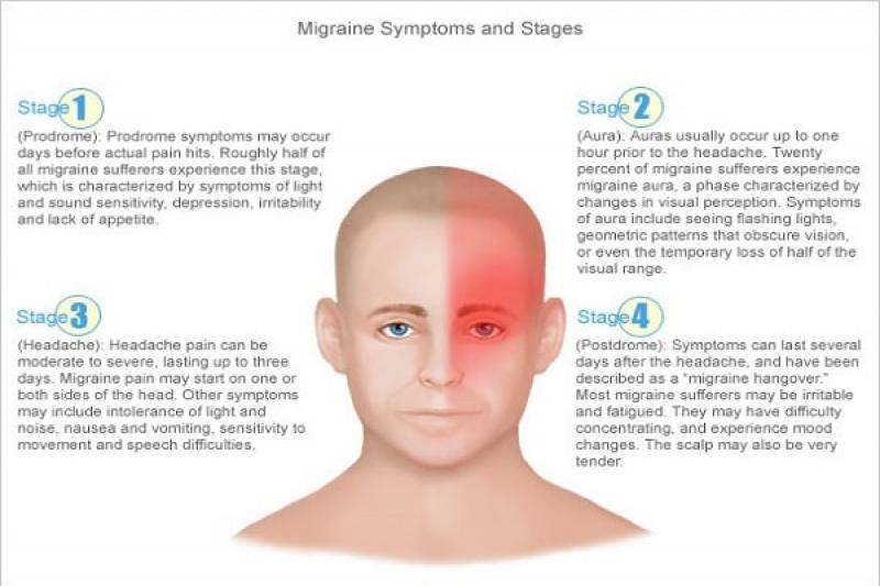 Nguyên nhân của bệnh đau nửa đầu Migraine