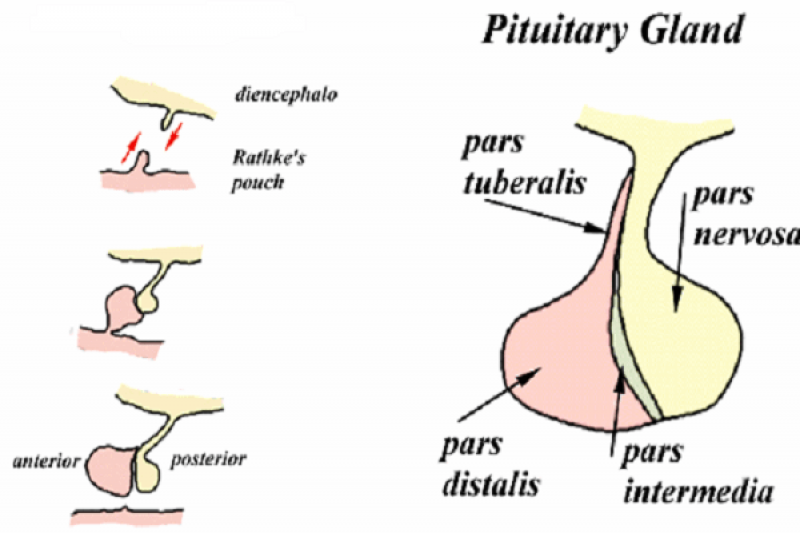 Nguyên nhân gây ra bệnh u sọ hầu là gì