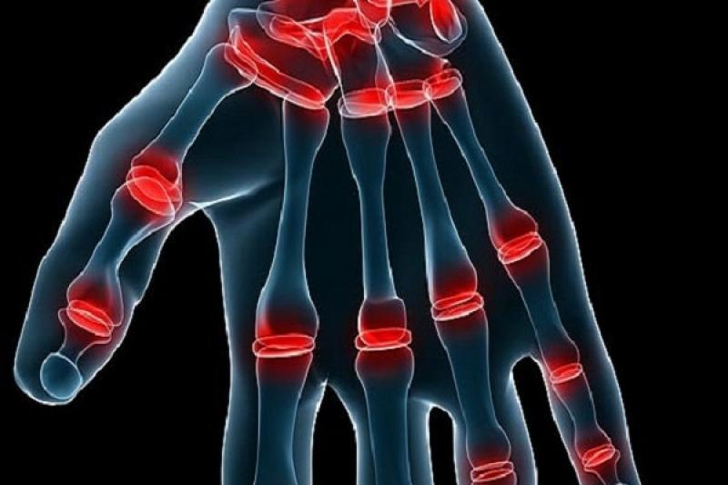 Nguyên nhân gây ra bệnh viêm khớp dạng thấp